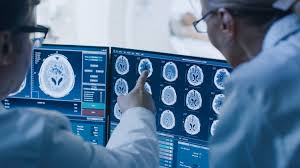 Accidente Cerebrovascular Isquémico