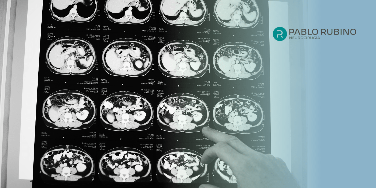 Agujeros de la base de cráneo: Anatomía y función